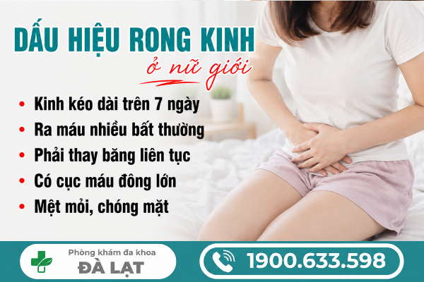 Hình ảnh minh họa